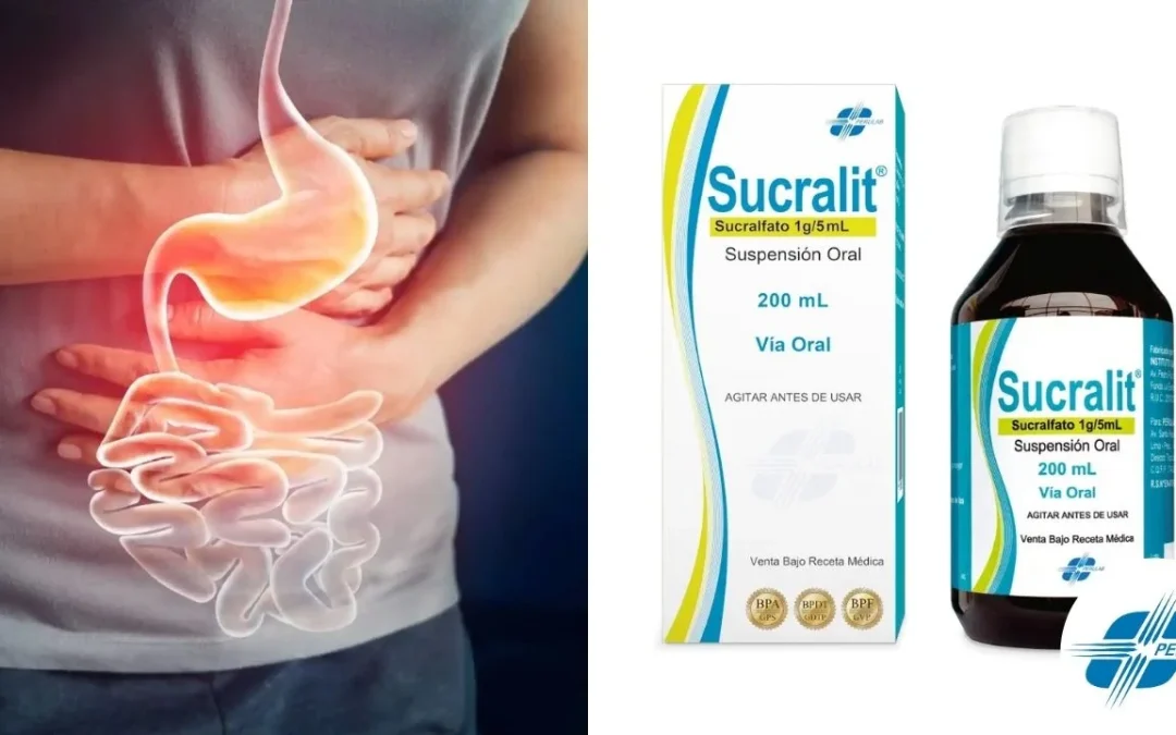 Para qué sirve el sucralfato en Perú y qué es